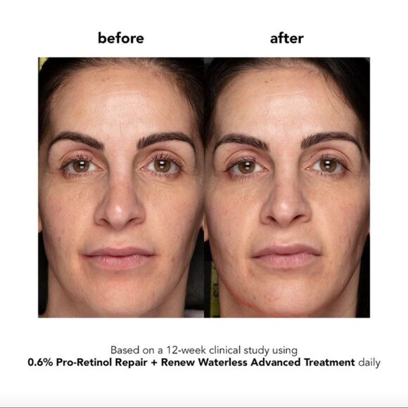 NEW Boscia 0.6% Pro-Retinol Repair + Renew Waterless Advanced Treatment - Picture 3 of 7